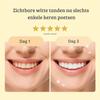 Dentara™ | Altijd stralend wit