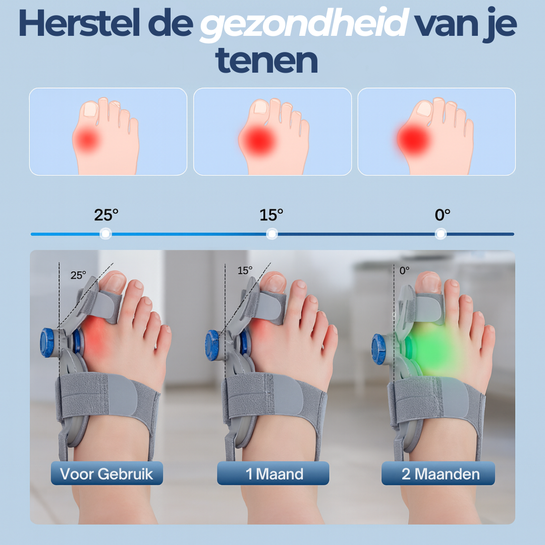 TeenFix™ | Herstel je tenen