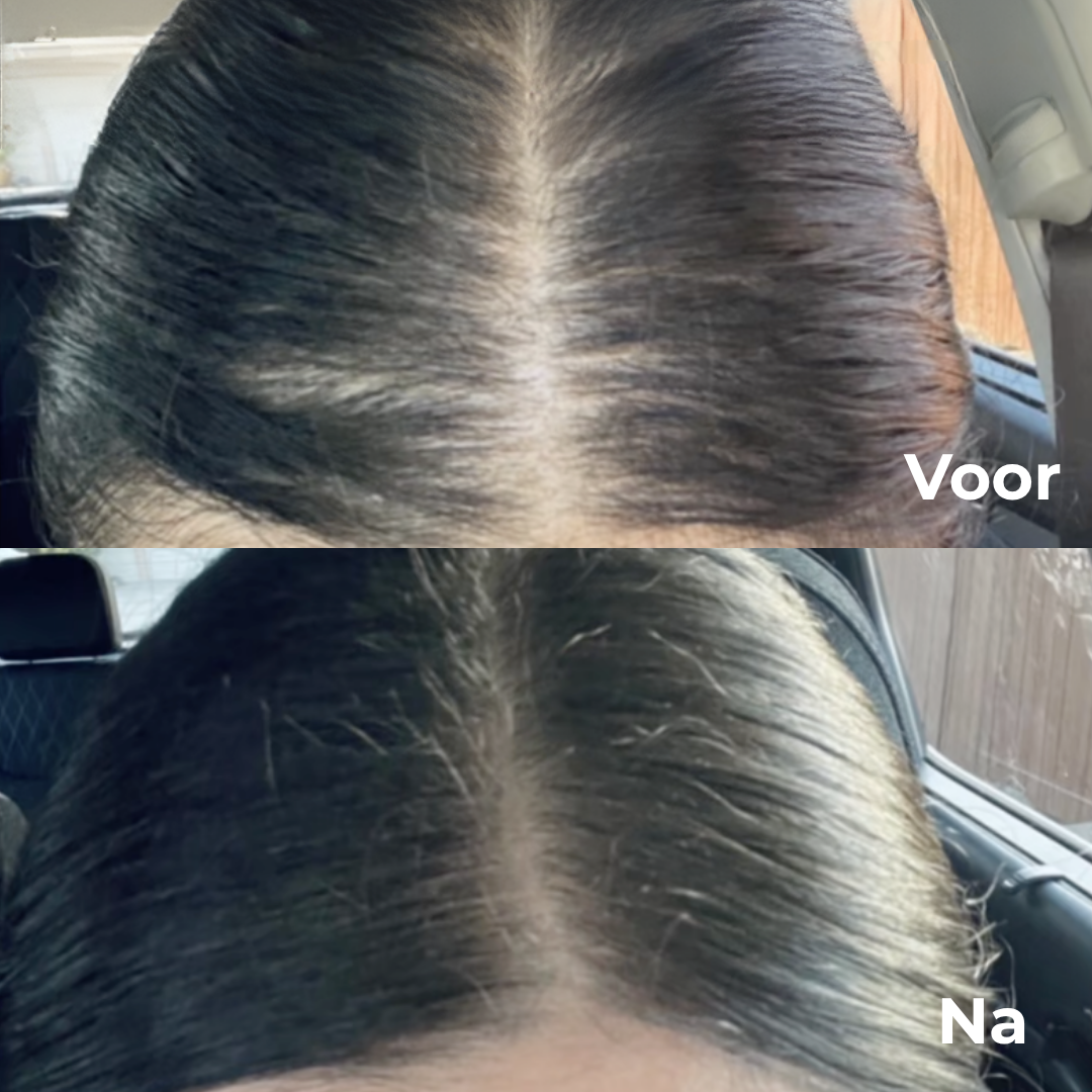 HaiRepair™ | Voel je weer mooi met gezond haar