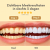 Tandorra™ | Vertrouwen in je lach