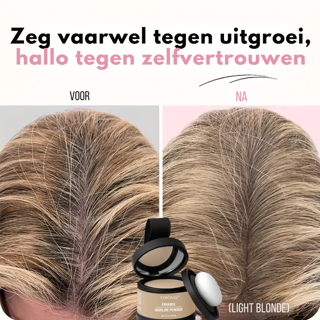 Rootify™ | Direct vollere haarlijn