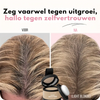Rootify™ | Direct vollere haarlijn