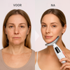 GlowLift™ | Geen slappe huid meer.
