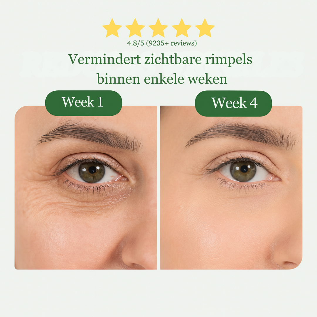 AloeCare™ | Zeg vaarwel tegen wallen